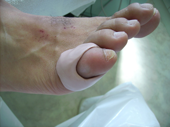 Orthesiologie Pedicure Mieke