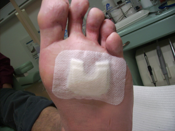 Drukvrij techniek Pedicure Mieke