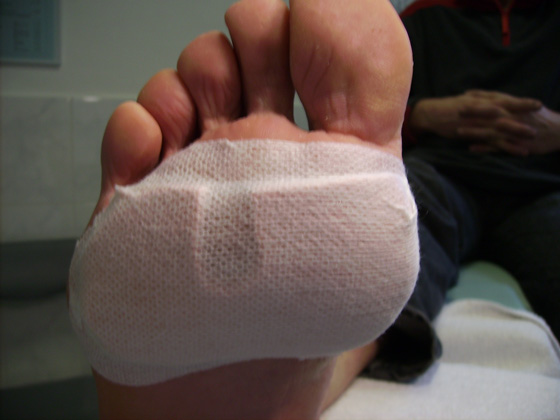 Drukvrij techniek Pedicure Mieke